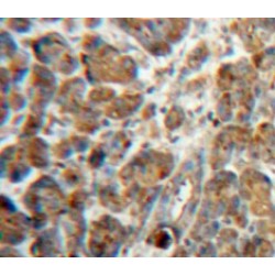 Neuronal Pentraxin II (NPTX2) Antibody