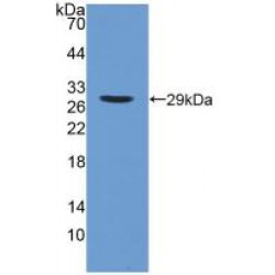 85 KDa Calcium-Independent Phospholipase A2 (PLA2G6) Antibody