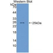 Western blot analysis of Human recombinant MAG Antibody.