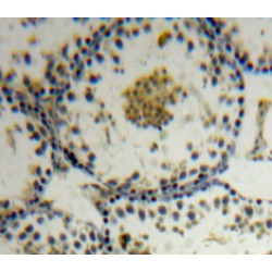 Apoptosis Antagonizing Transcription Factor (AATF) Antibody