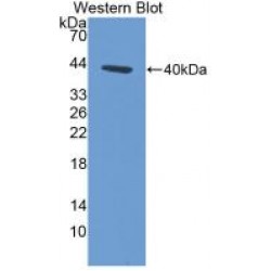 Keratin 14 (KRT14) Antibody