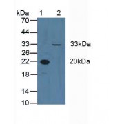 Western blot analysis of (1) Human Blood Cells and (2) Human HeLa cells.