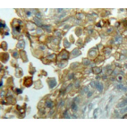 Cyclin D3 (CCND3) Antibody
