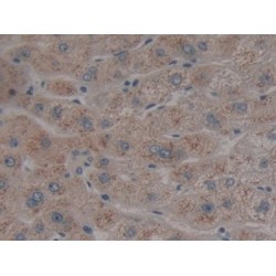 Neuroglobin (NGB) Antibody