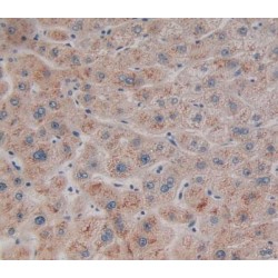 Neuroglobin (NGB) Antibody
