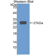 Western blot analysis of the recombinant protein.