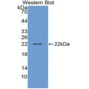 Western blot analysis of recombinant Human PGD2S.