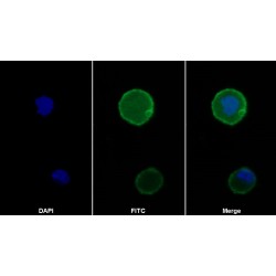 Programmed Cell Death Protein 1 (PDCD1) Antibody