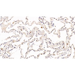 Programmed Cell Death Protein 1 (PDCD1) Antibody