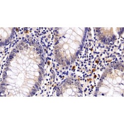 Programmed Cell Death Protein 1 (PDCD1) Antibody