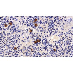 Programmed Cell Death Protein 1 (PDCD1) Antibody