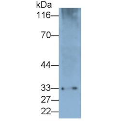 Programmed Cell Death Protein 1 (PDCD1) Antibody