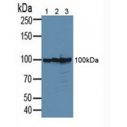 Western blot analysis of (1) Human 293T Cells, (2) Human PC-3 Cells and (3) Human MCF-7 Cells.