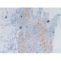 Protein Tyrosine Phosphatase Receptor Type H (PTPRH) Antibody