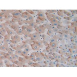 Protein Tyrosine Phosphatase Receptor Type H (PTPRH) Antibody