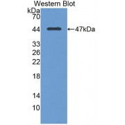 Western blot analysis of recombinant Human NMU.