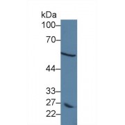 Western blot analysis of Human MCF7 cell lysate, using Human DCT Antibody (5 µg/ml) and HRP-conjugated Goat Anti-Rabbit antibody (<a href="https://www.abbexa.com/index.php?route=product/search&amp;search=abx400043" target="_blank">abx400043</a>, 0.2 µg/ml).