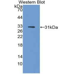 L-Dopachrome Tautomerase (DCT) Antibody