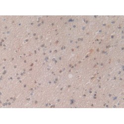 Heat Shock 70 kDa Protein 1A (HSPA1A) Antibody