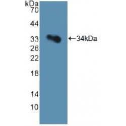 Platelet Glycoprotein Ib Alpha Chain (GP1Ba) Antibody