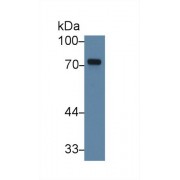 Western blot analysis of Human K562 cell lysate, using Human TXLNa Antibody (3 µg/ml) and HRP-conjugated Goat Anti-Rabbit antibody (<a href="https://www.abbexa.com/index.php?route=product/search&amp;search=abx400043" target="_blank">abx400043</a>, 0.2 µg/ml).