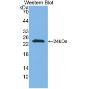 Western blot analysis of the recombinant CNTNAP4.