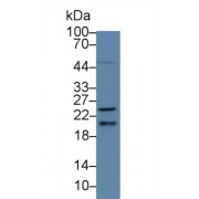 Western blot analysis of Human HepG2 cell lysate, using Human HRAS Antibody (5 µg/ml) and HRP-conjugated Goat Anti-Rabbit antibody (<a href="https://www.abbexa.com/index.php?route=product/search&amp;search=abx400043" target="_blank">abx400043</a>, 0.2 µg/ml).