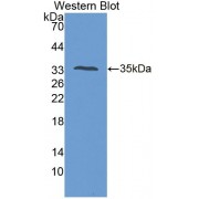 Western blot analysis of recombinant Human PTPRS Protein.