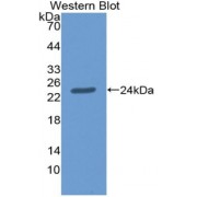 Western blot analysis of recombinant Human AGRN.