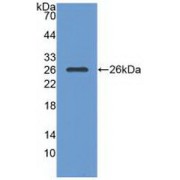 Western blot analysis of recombinant Human RASA1.