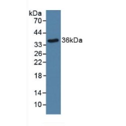 Signal Transducer And Activator of Transcription 5B (STAT5B) Antibody