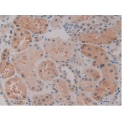 Signal Transducer And Activator of Transcription 5B (STAT5B) Antibody