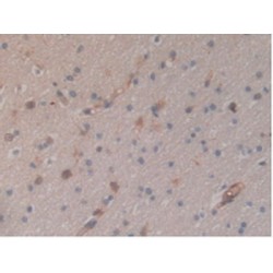 Signal Transducer And Activator of Transcription 5B (STAT5B) Antibody