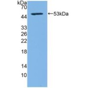 Western blot analysis of recombinant Human CD83.