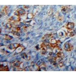 Cluster of Differentiation 83 (CD83) Antibody