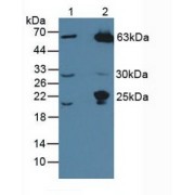 Western blot analysis of (1) Human HeLa cells and (2) Mouse Liver Tissue.