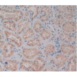 Mannose Associated Serine Protease 1 (MASP1) Antibody