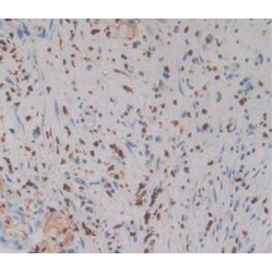 Mannose Associated Serine Protease 1 (MASP1) Antibody