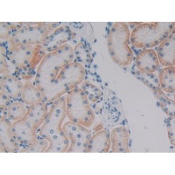 Plakophilin 1 (PKP1) Antibody