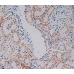 Plakophilin 1 (PKP1) Antibody