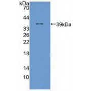 Western blot analysis of recombinant Human ALOX12.