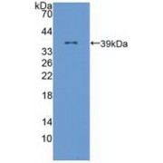 abx128821
