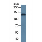 Western blot analysis of Human A431 cell lysate, using Human LAMC2 Antibody (5 µg/ml) and HRP-conjugated Goat Anti-Rabbit antibody (<a href="https://www.abbexa.com/index.php?route=product/search&amp;search=abx400043" target="_blank">abx400043</a>, 0.2 µg/ml).