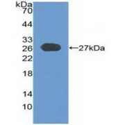 Western blot analysis of recombinant Human CYLD.