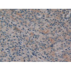 Cylindromatosis (CYLD) Antibody