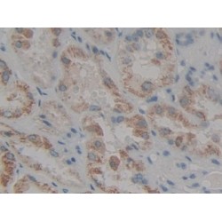 Loricrin (LOR) Antibody