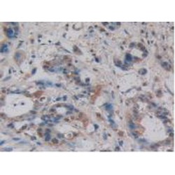Villin 1 (VIL1) Antibody