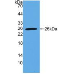 Tumor Necrosis Factor Ligand Superfamily Member 15 (TNFSF15) Antibody