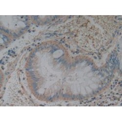 Tumor Necrosis Factor Ligand Superfamily Member 15 (TNFSF15) Antibody
