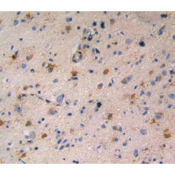 N-Acetyl-D-Glucosamine 2-Epimerase (RENBP) Antibody
